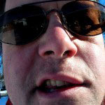 Paralysie faciale Paralysie faciale